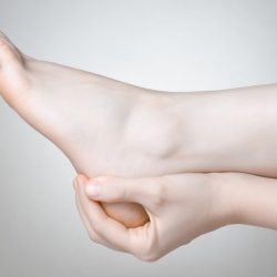 Planter Fasciitis