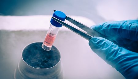 Stem Cell Treatments